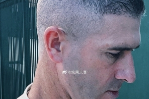 博主:蒙哥马利将在基地开会,此前被英博助教锁喉红印清晰可见